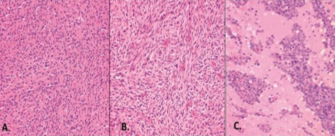 Hera BioLabs - Blog - Hera BioLabs Is Expanding Our Orthotopic Brain Offerings In Rats-Figure 1 Image