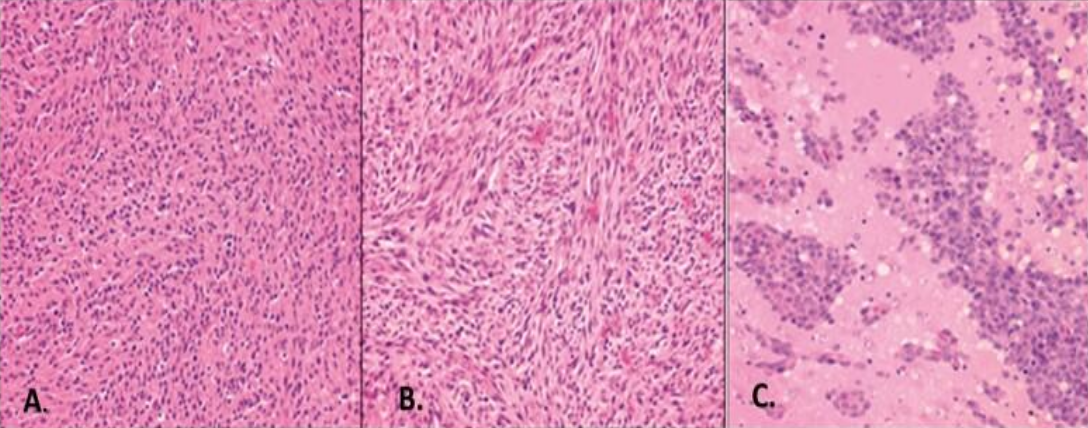 Hera BioLabs - Blog - Hera BioLabs Is Expanding Our Orthotopic Brain Offerings In Rats-Figure 1 Image