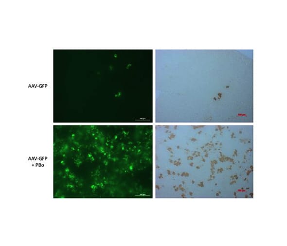 Hera - Blog - In Vivo Liver Gene Delivery - Figure 2