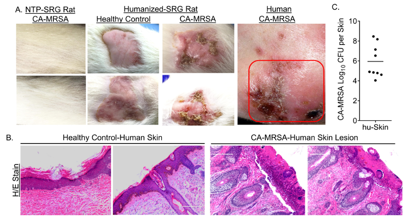 Hera Biolabs - Blog - Humanized Skin and Immune Cell Rodent Models Revolutionizing Scientific Research - Image 2